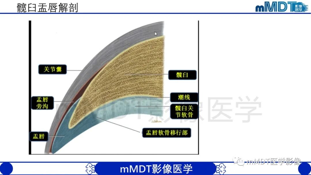 mmd在医学上什么意思股骨髋臼撞击症影像学改变_https://www.jmylbn.com_新闻资讯_第7张