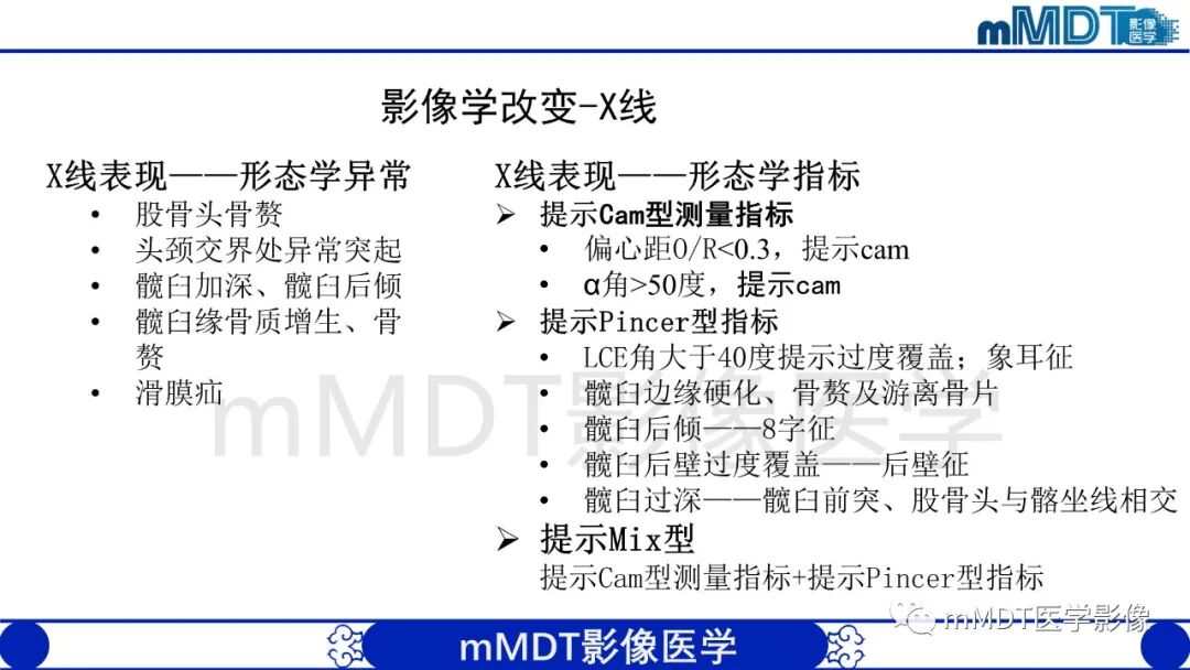 mmd在医学上什么意思股骨髋臼撞击症影像学改变_https://www.jmylbn.com_新闻资讯_第12张