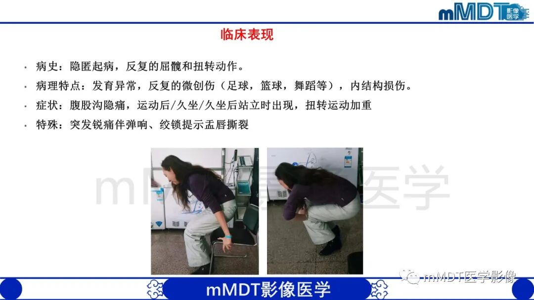 mmd在医学上什么意思股骨髋臼撞击症影像学改变_https://www.jmylbn.com_新闻资讯_第5张