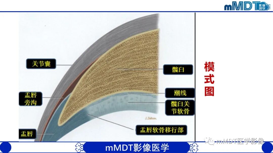 mmd在医学上什么意思髋关节疼痛影像与临床（二）--王勇老师公开课_https://www.jmylbn.com_新闻资讯_第22张
