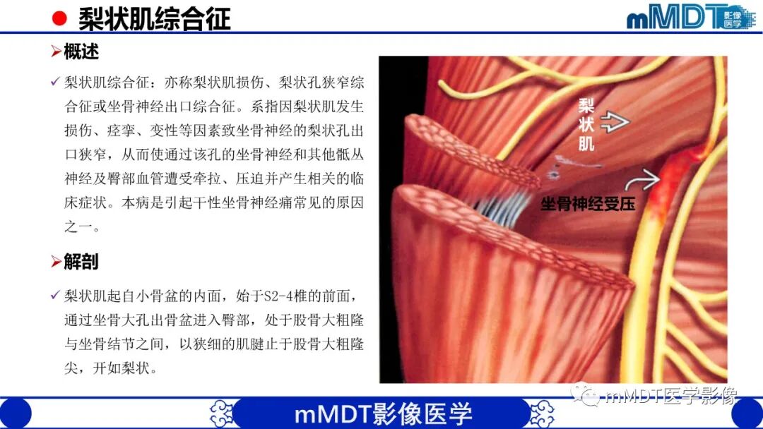 mmd在医学上什么意思髋关节疼痛影像与临床（二）--王勇老师公开课_https://www.jmylbn.com_新闻资讯_第17张