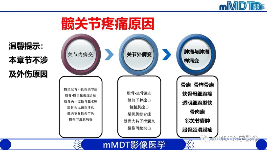 mmd在医学上什么意思髋关节疼痛临床与影像（一）_https://www.jmylbn.com_新闻资讯_第5张