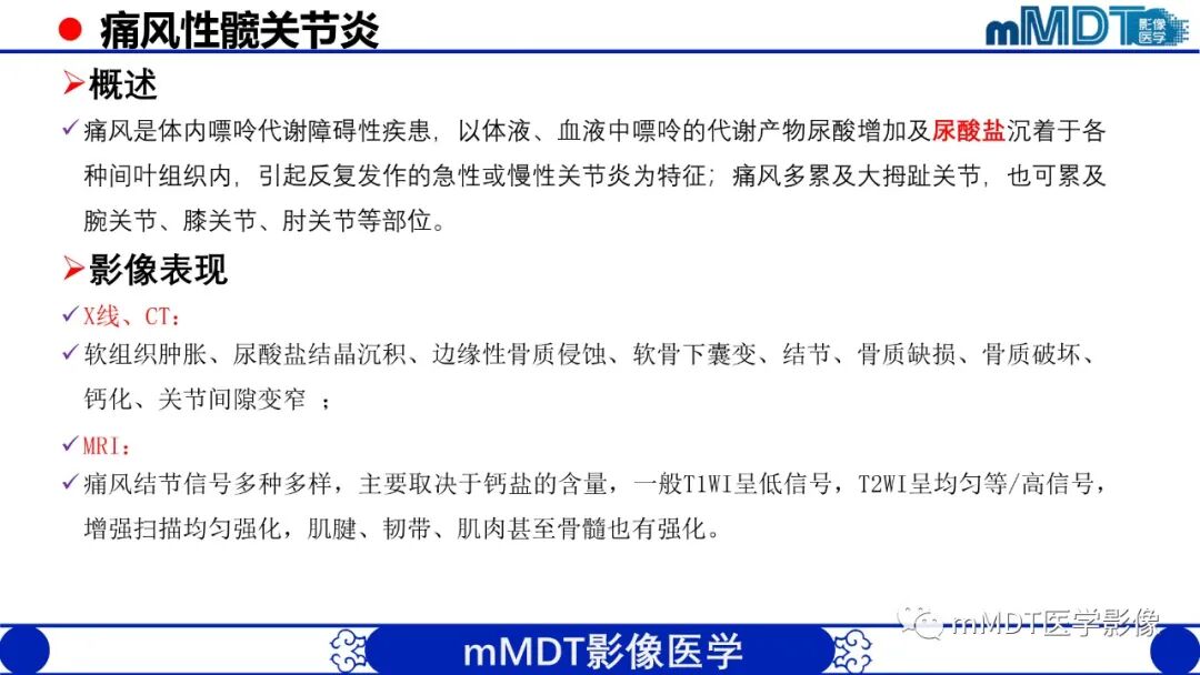 mmd在医学上什么意思髋关节疼痛临床与影像（一）_https://www.jmylbn.com_新闻资讯_第50张