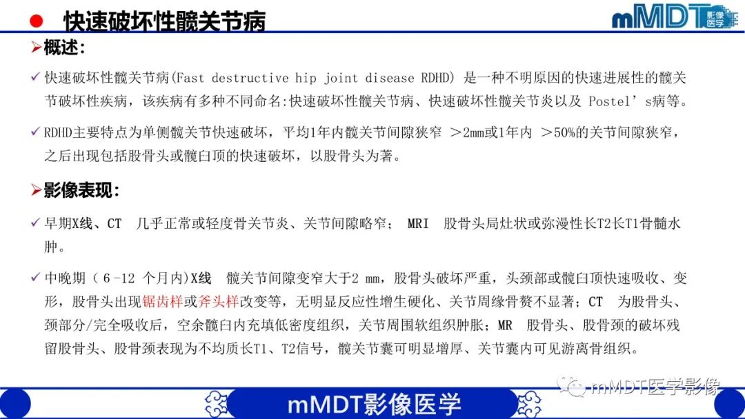 mmd在医学上什么意思髋关节疼痛临床与影像（一）_https://www.jmylbn.com_新闻资讯_第35张