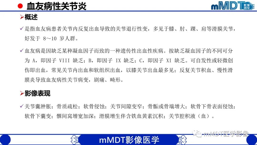 mmd在医学上什么意思髋关节疼痛临床与影像（一）_https://www.jmylbn.com_新闻资讯_第52张
