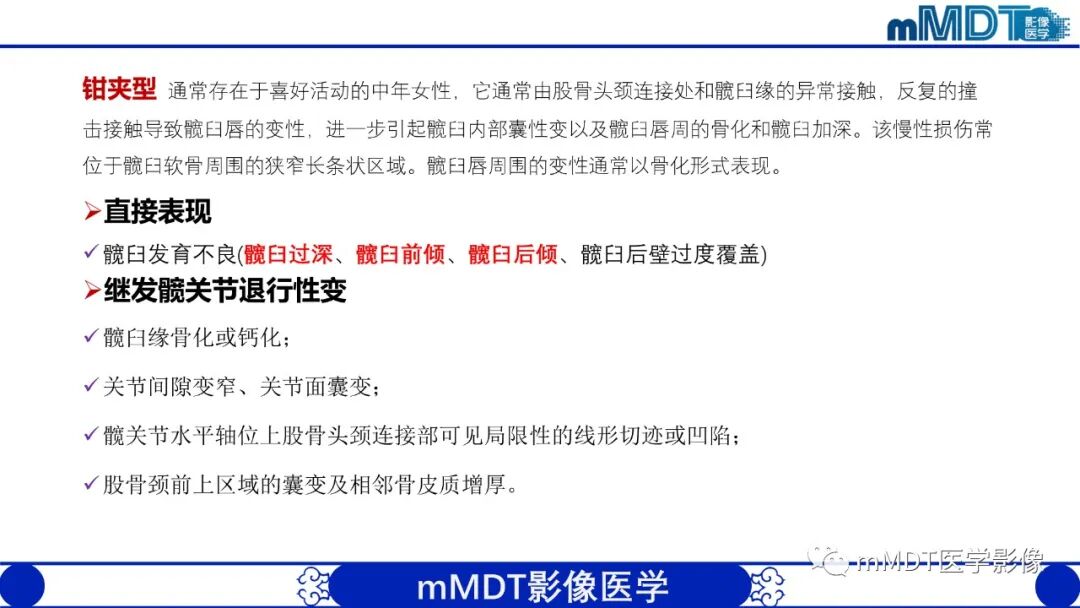 mmd在医学上什么意思髋关节疼痛临床与影像（一）_https://www.jmylbn.com_新闻资讯_第22张