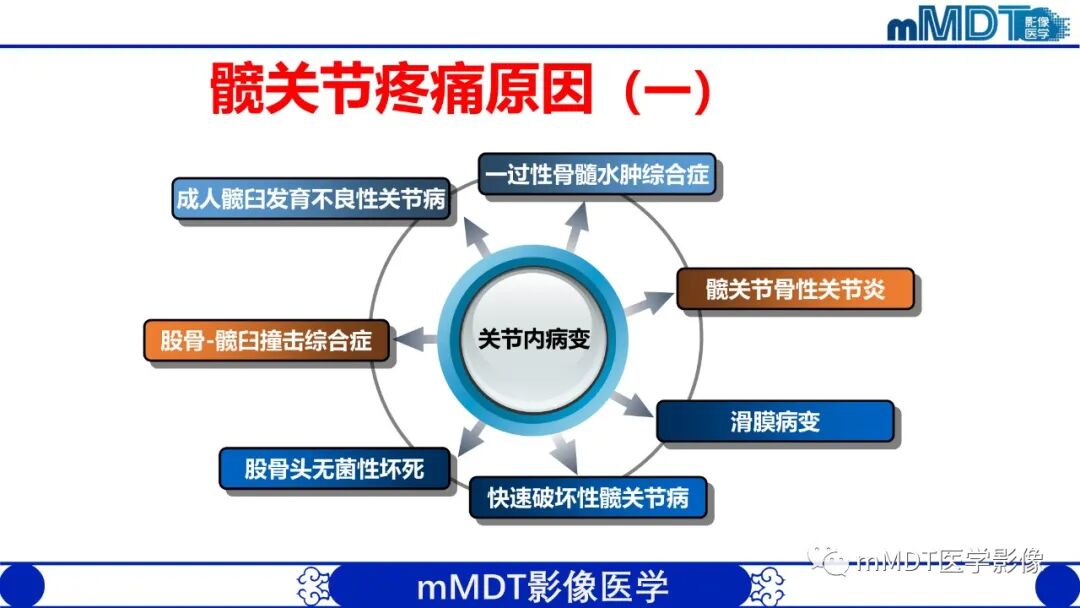 mmd在医学上什么意思髋关节疼痛临床与影像（一）_https://www.jmylbn.com_新闻资讯_第6张