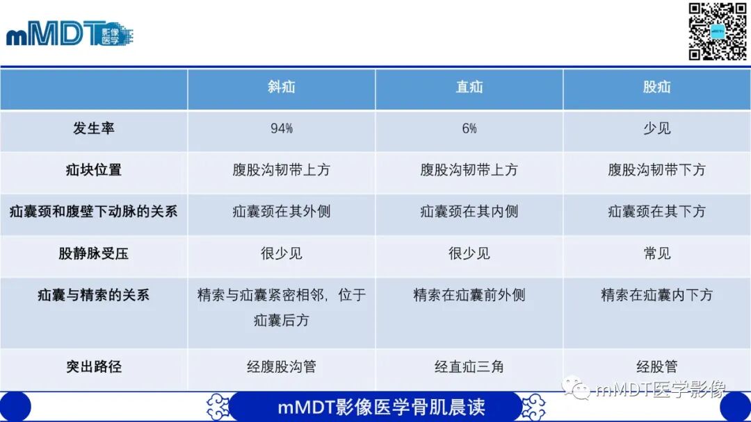 mmd在医学上什么意思常见腹外疝的影像诊断（修正版）_https://www.jmylbn.com_新闻资讯_第18张
