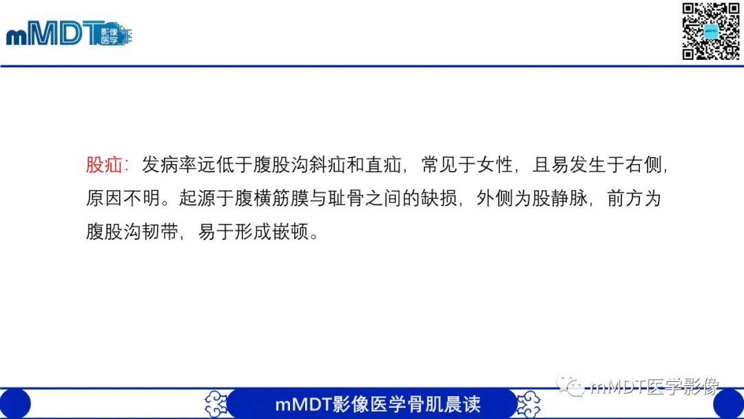 mmd在医学上什么意思常见腹外疝的影像诊断（修正版）_https://www.jmylbn.com_新闻资讯_第13张