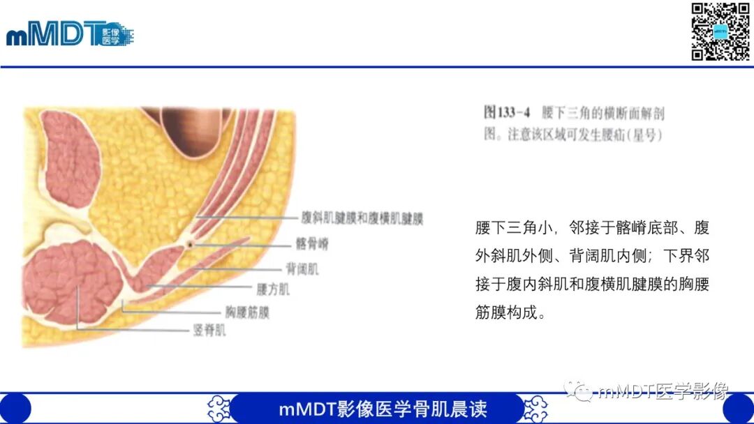 mmd在医学上什么意思常见腹外疝的影像诊断（修正版）_https://www.jmylbn.com_新闻资讯_第26张