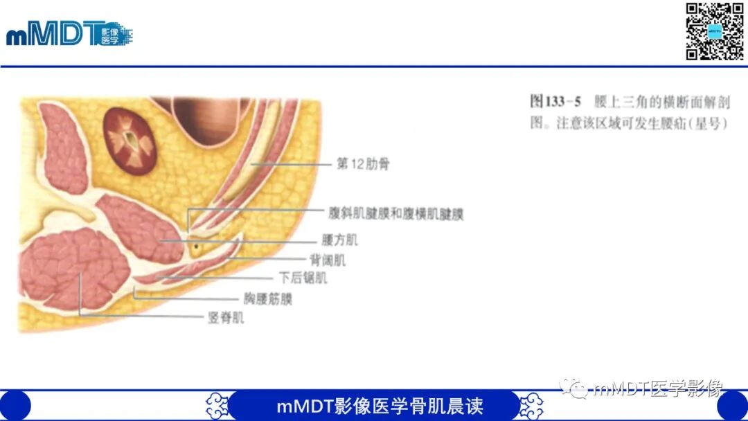 mmd在医学上什么意思常见腹外疝的影像诊断（修正版）_https://www.jmylbn.com_新闻资讯_第27张