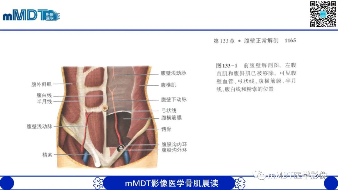 mmd在医学上什么意思常见腹外疝的影像诊断（修正版）_https://www.jmylbn.com_新闻资讯_第6张