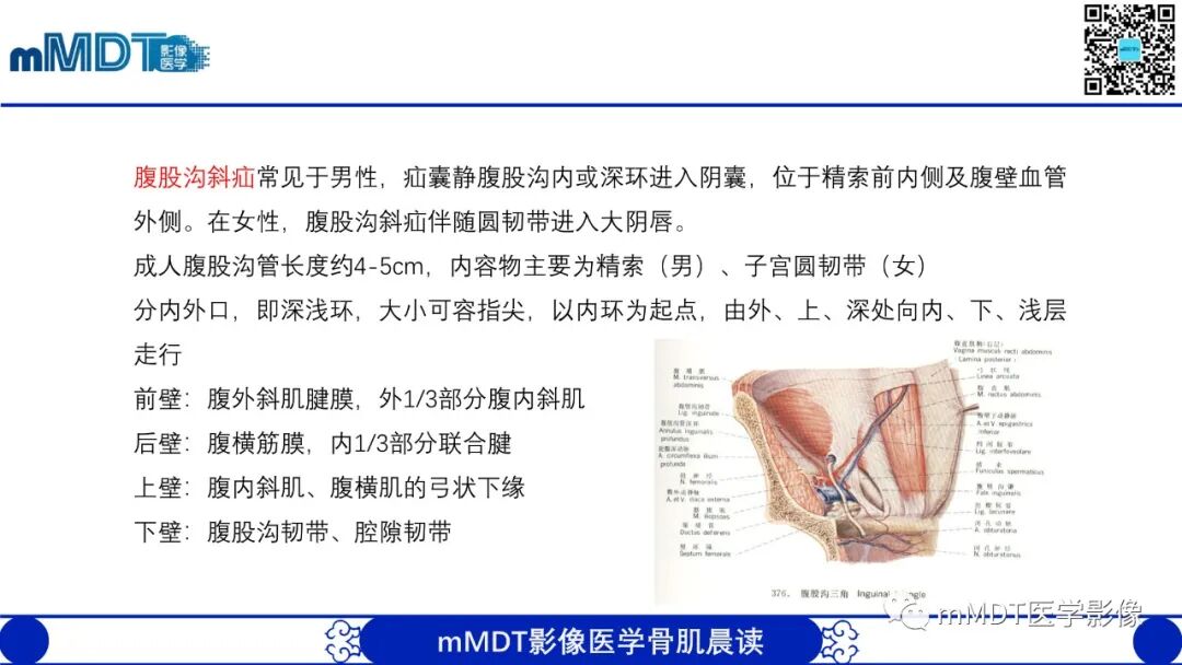 mmd在医学上什么意思常见腹外疝的影像诊断（修正版）_https://www.jmylbn.com_新闻资讯_第5张