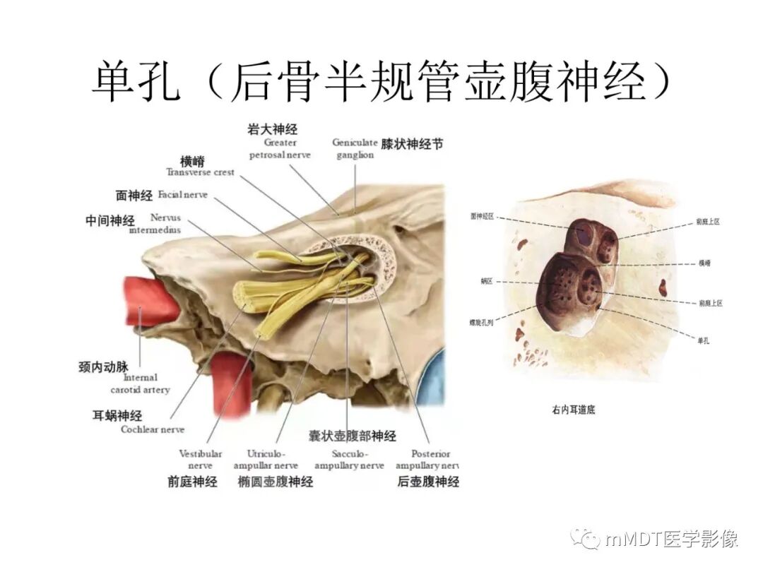 mmd在医学上什么意思触底四神共一门——穿行在内耳道的神经们_https://www.jmylbn.com_新闻资讯_第71张