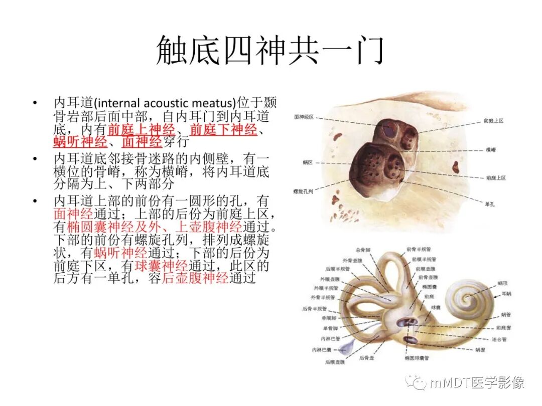 mmd在医学上什么意思触底四神共一门——穿行在内耳道的神经们_https://www.jmylbn.com_新闻资讯_第3张