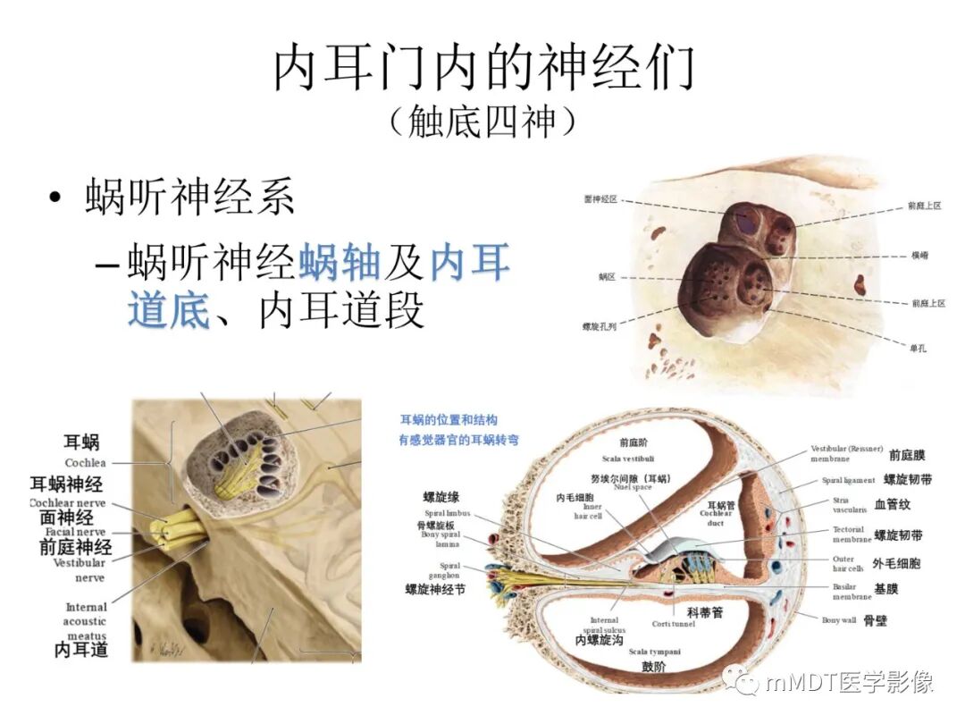 mmd在医学上什么意思触底四神共一门——穿行在内耳道的神经们_https://www.jmylbn.com_新闻资讯_第5张