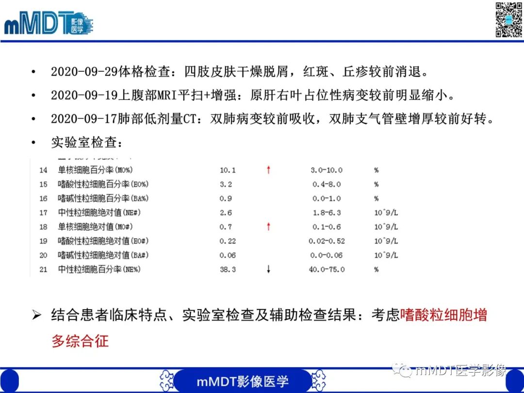 mmd在医学上什么意思嗜酸粒细胞增多综合征_https://www.jmylbn.com_新闻资讯_第12张