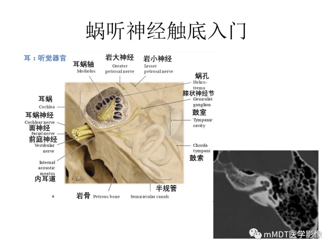 mmd在医学上什么意思触底四神共一门——穿行在内耳道的神经们_https://www.jmylbn.com_新闻资讯_第12张