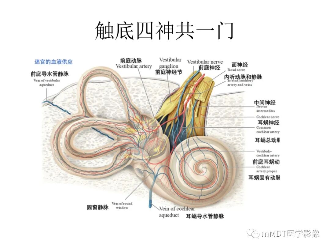 mmd在医学上什么意思触底四神共一门——穿行在内耳道的神经们_https://www.jmylbn.com_新闻资讯_第4张