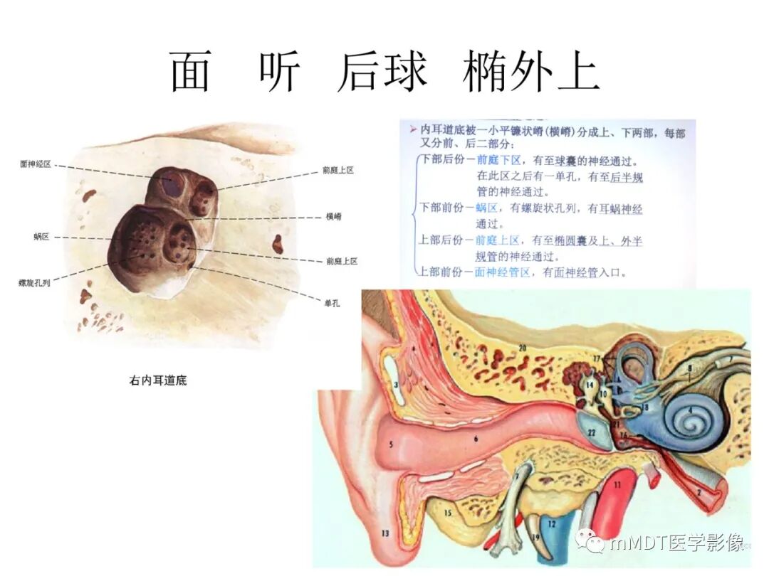 mmd在医学上什么意思触底四神共一门——穿行在内耳道的神经们_https://www.jmylbn.com_新闻资讯_第24张