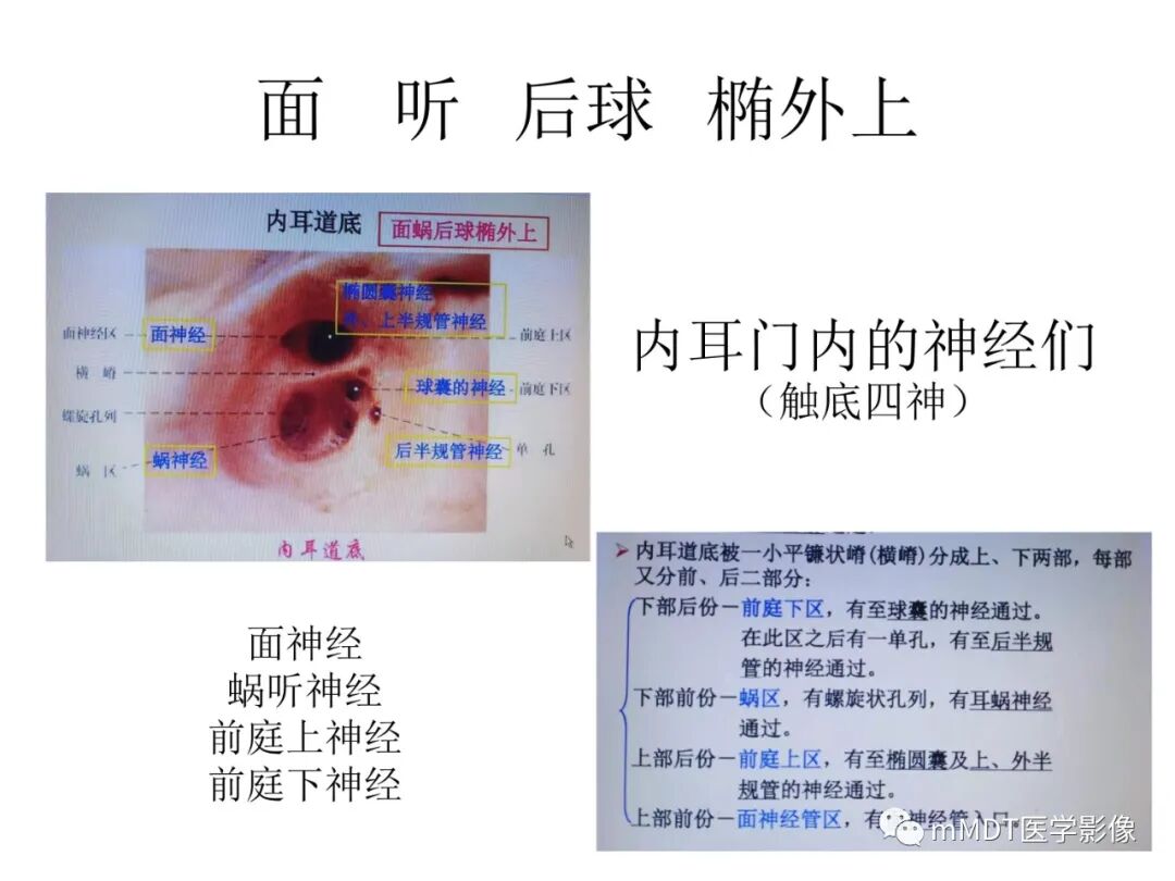 mmd在医学上什么意思触底四神共一门——穿行在内耳道的神经们_https://www.jmylbn.com_新闻资讯_第10张