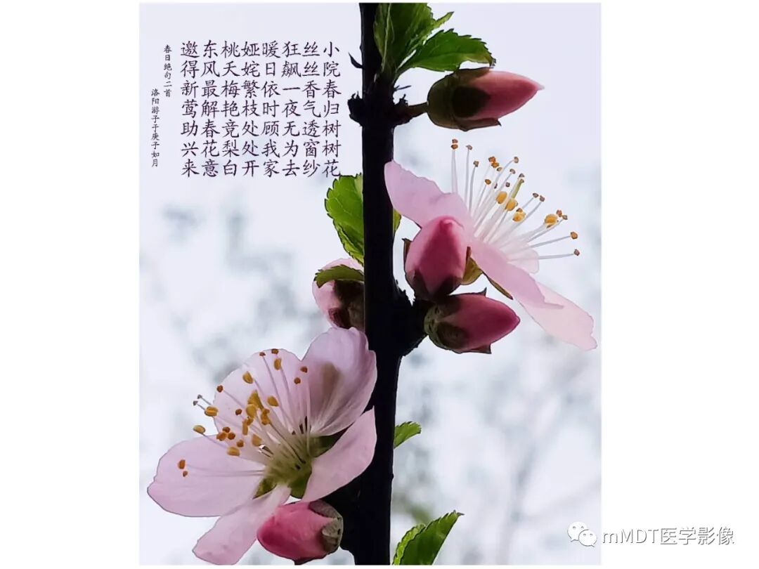 mmd在医学上什么意思触底四神共一门——穿行在内耳道的神经们_https://www.jmylbn.com_新闻资讯_第22张