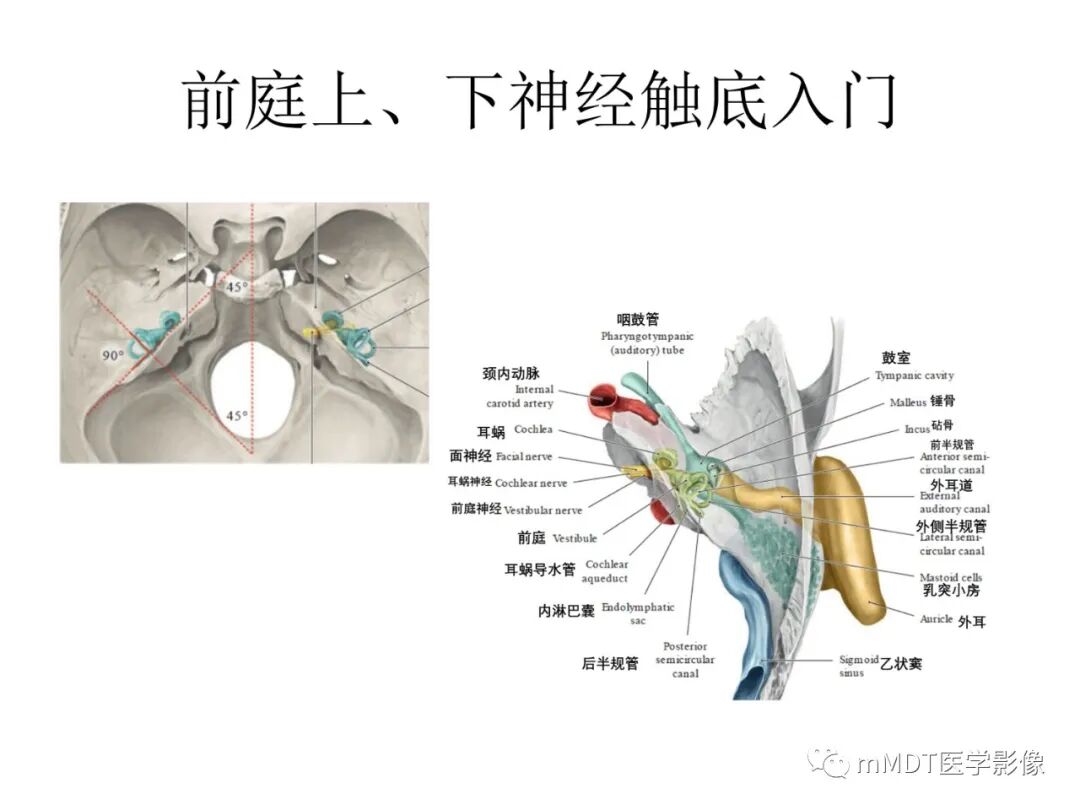 mmd在医学上什么意思触底四神共一门——穿行在内耳道的神经们_https://www.jmylbn.com_新闻资讯_第15张