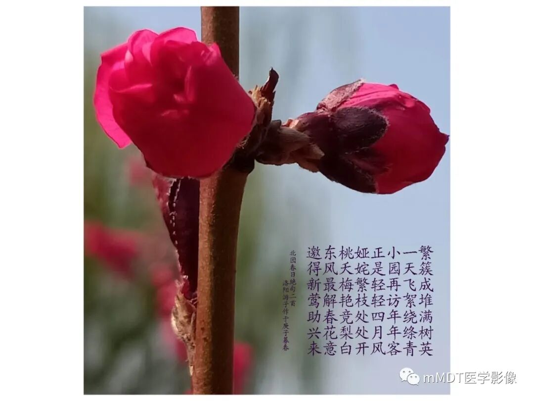 mmd在医学上什么意思触底四神共一门——穿行在内耳道的神经们_https://www.jmylbn.com_新闻资讯_第31张