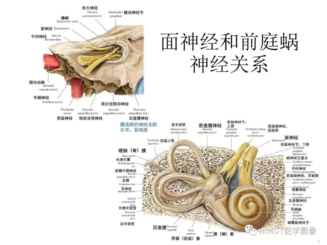 mmd在医学上什么意思触底四神共一门——穿行在内耳道的神经们_https://www.jmylbn.com_新闻资讯_第23张