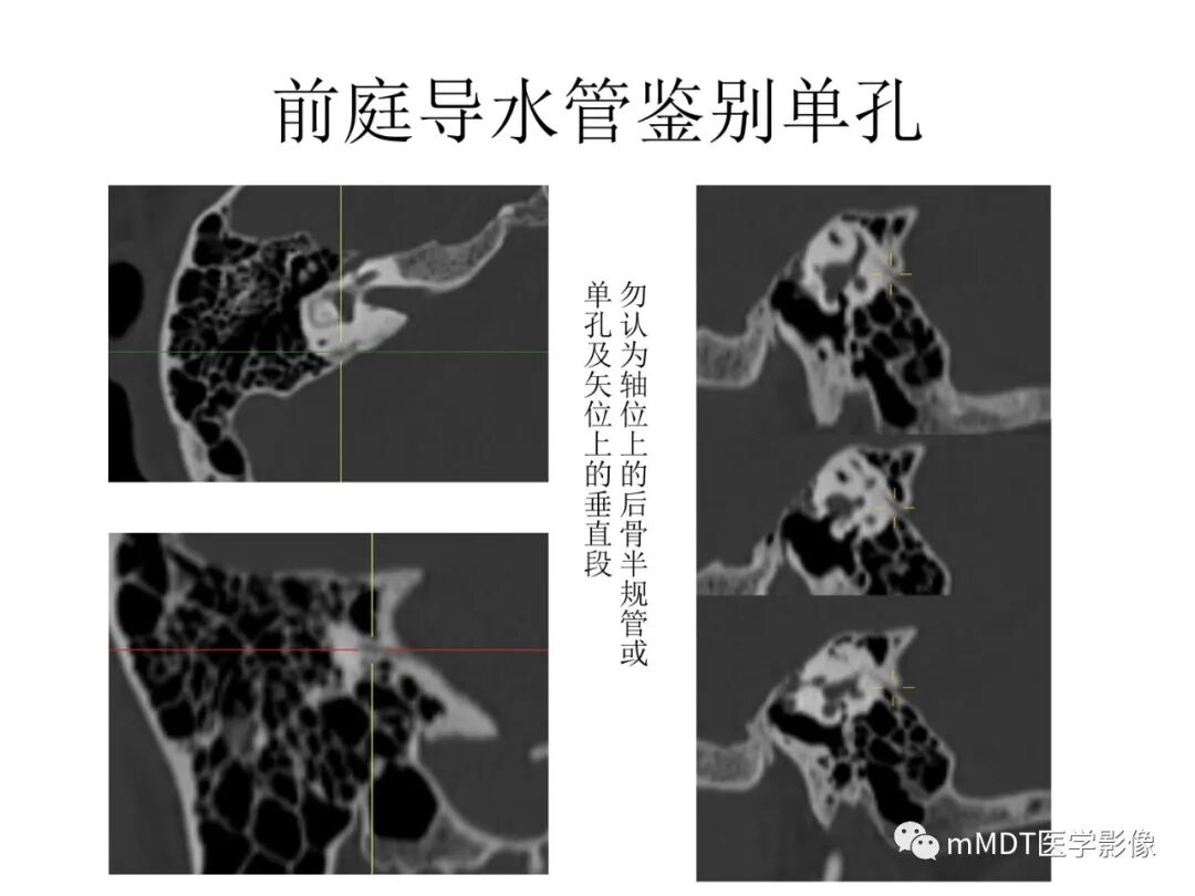 mmd在医学上什么意思触底四神共一门——穿行在内耳道的神经们_https://www.jmylbn.com_新闻资讯_第79张