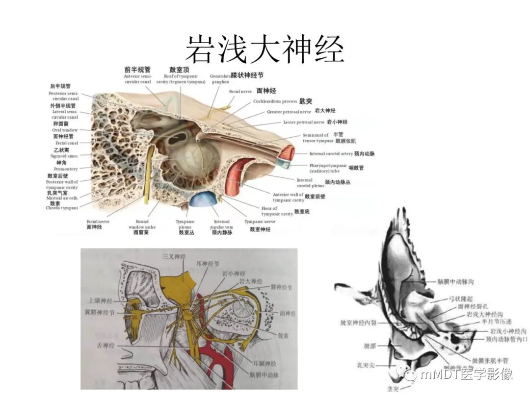 mmd在医学上什么意思触底四神共一门——穿行在内耳道的神经们_https://www.jmylbn.com_新闻资讯_第69张