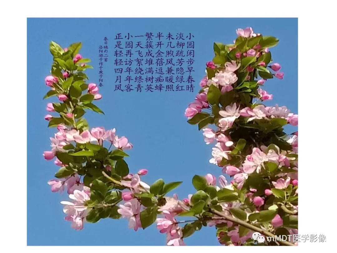 mmd在医学上什么意思触底四神共一门——穿行在内耳道的神经们_https://www.jmylbn.com_新闻资讯_第64张