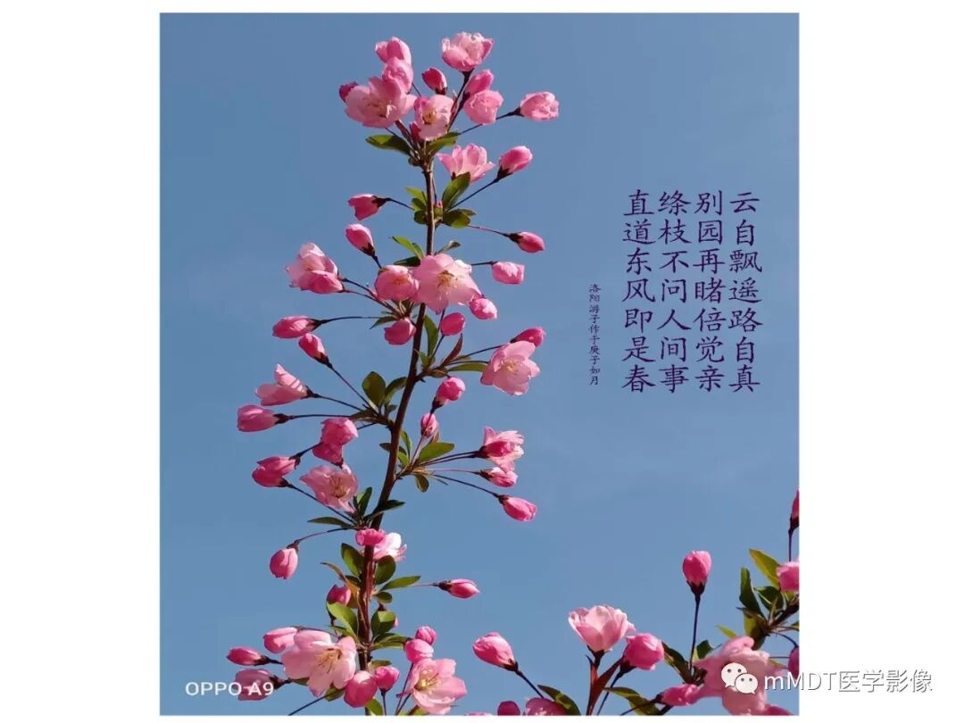 mmd在医学上什么意思触底四神共一门——穿行在内耳道的神经们_https://www.jmylbn.com_新闻资讯_第70张