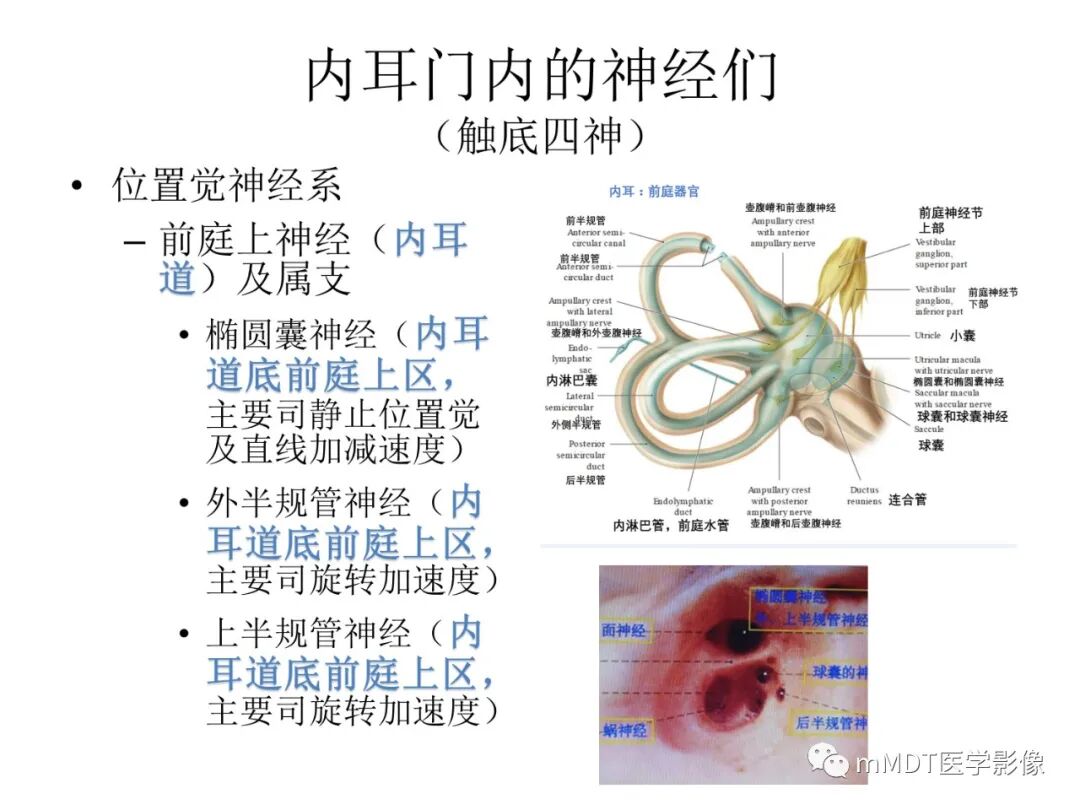 mmd在医学上什么意思触底四神共一门——穿行在内耳道的神经们_https://www.jmylbn.com_新闻资讯_第6张
