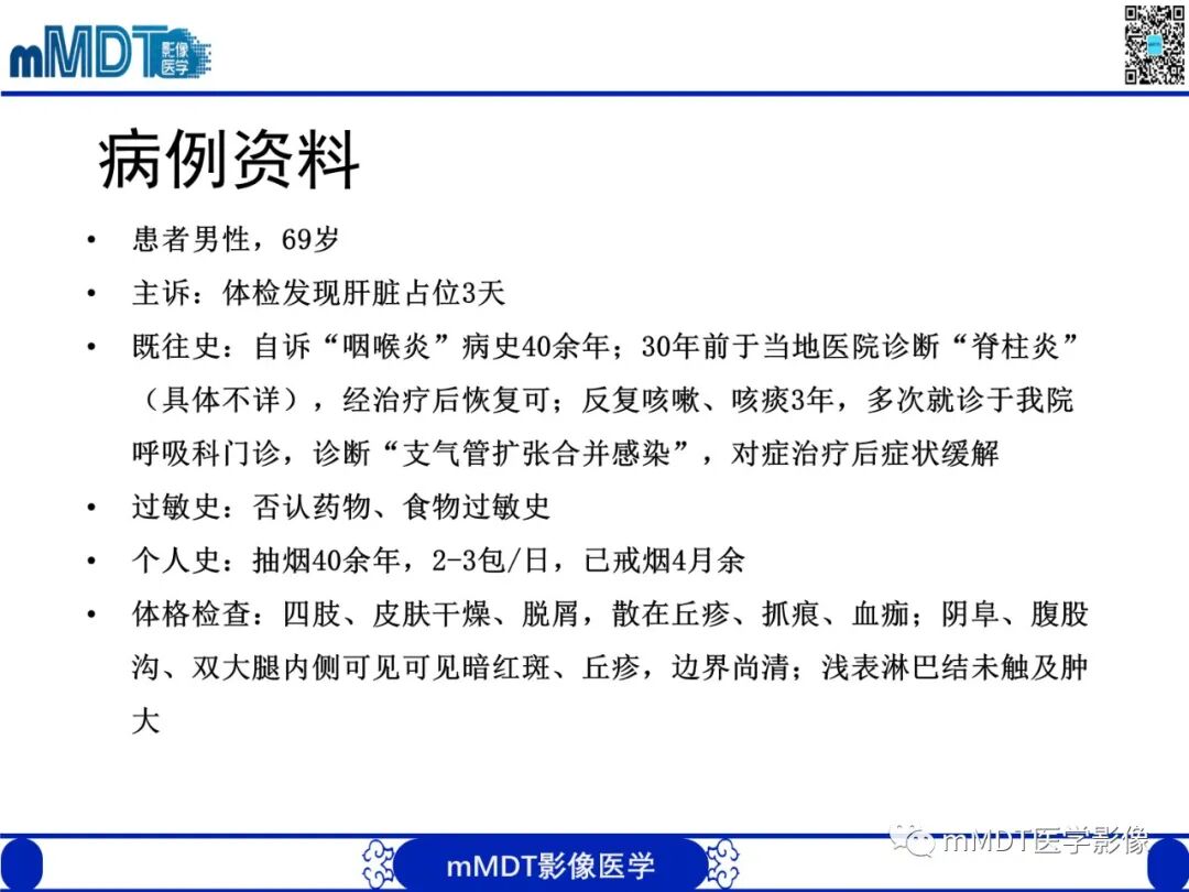 mmd在医学上什么意思嗜酸粒细胞增多综合征_https://www.jmylbn.com_新闻资讯_第3张