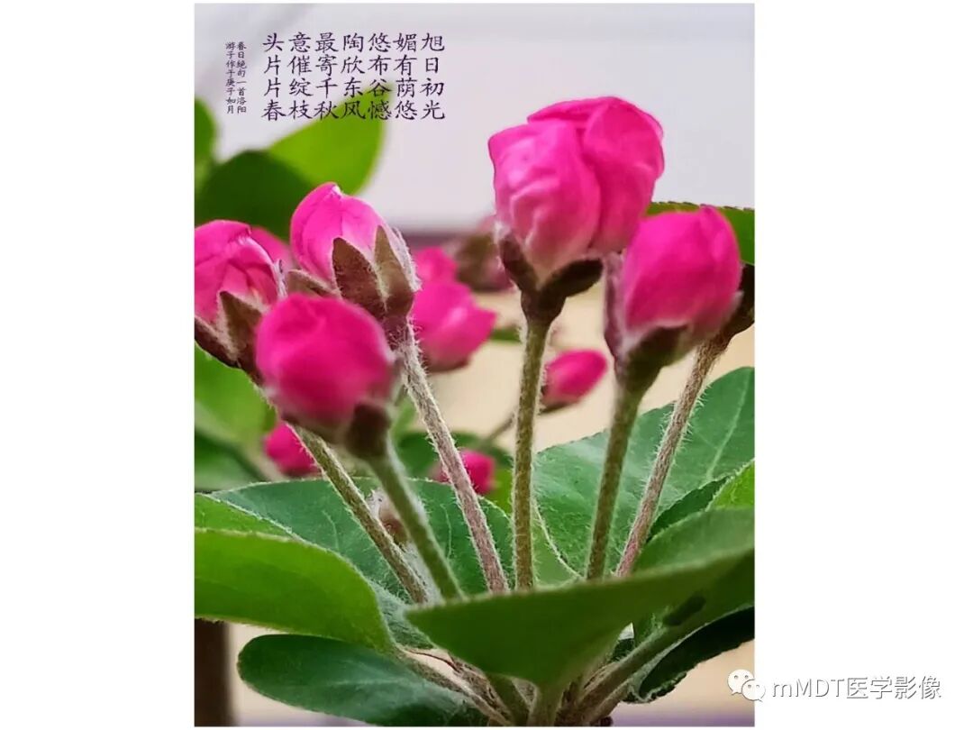 mmd在医学上什么意思触底四神共一门——穿行在内耳道的神经们_https://www.jmylbn.com_新闻资讯_第11张