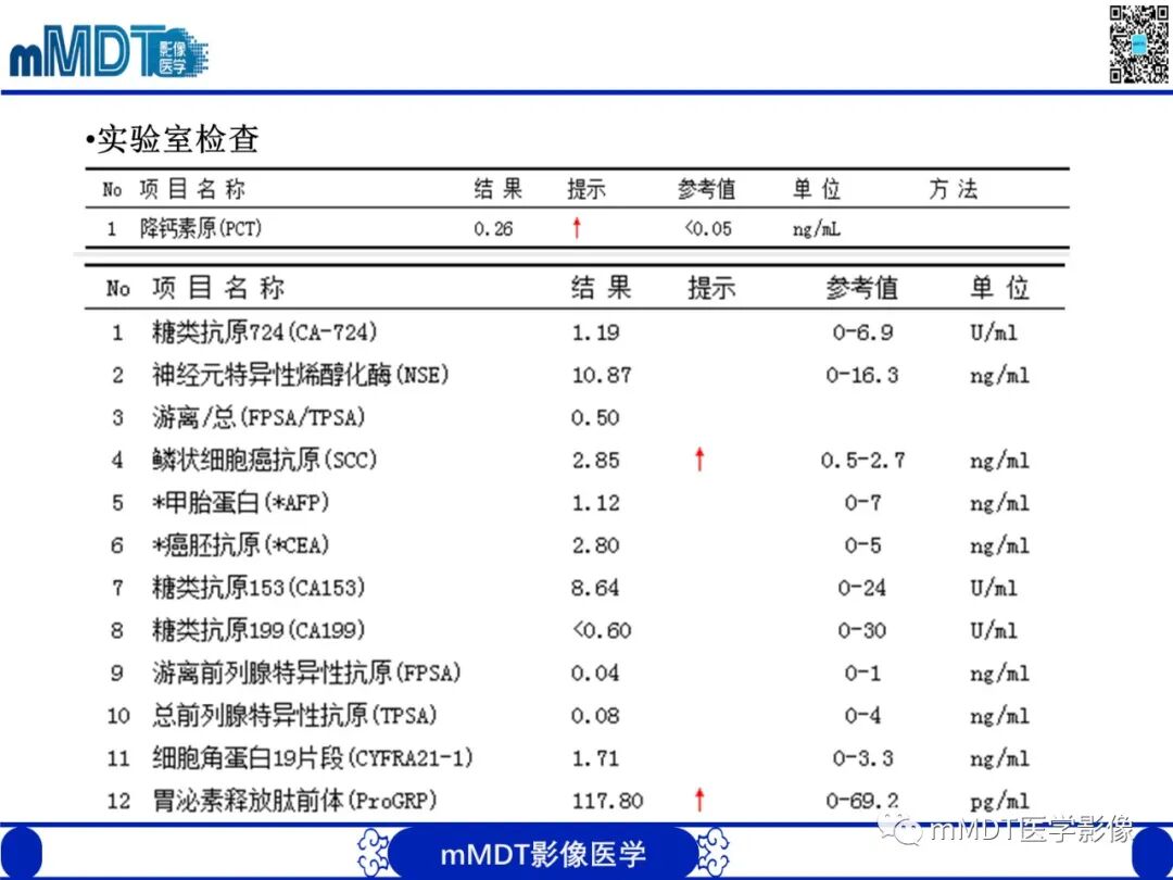 mmd在医学上什么意思嗜酸粒细胞增多综合征_https://www.jmylbn.com_新闻资讯_第4张