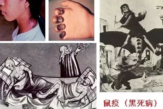 肺鼠疫病人是通过呼吸,谈话,咳嗽等, 借飞沫形成"人-人"的方式传播