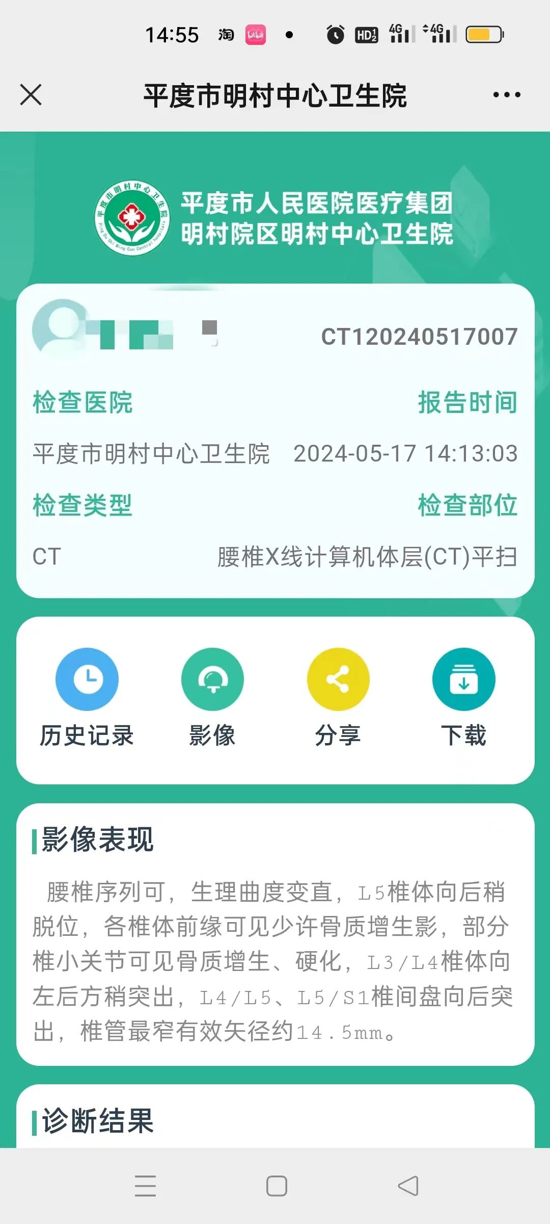 为什么x光片用胶片【便民服务】明村中心卫生院“云胶片”正式上线啦——用手机随时随地就能看X光片、CT片_https://www.jmylbn.com_新闻资讯_第4张