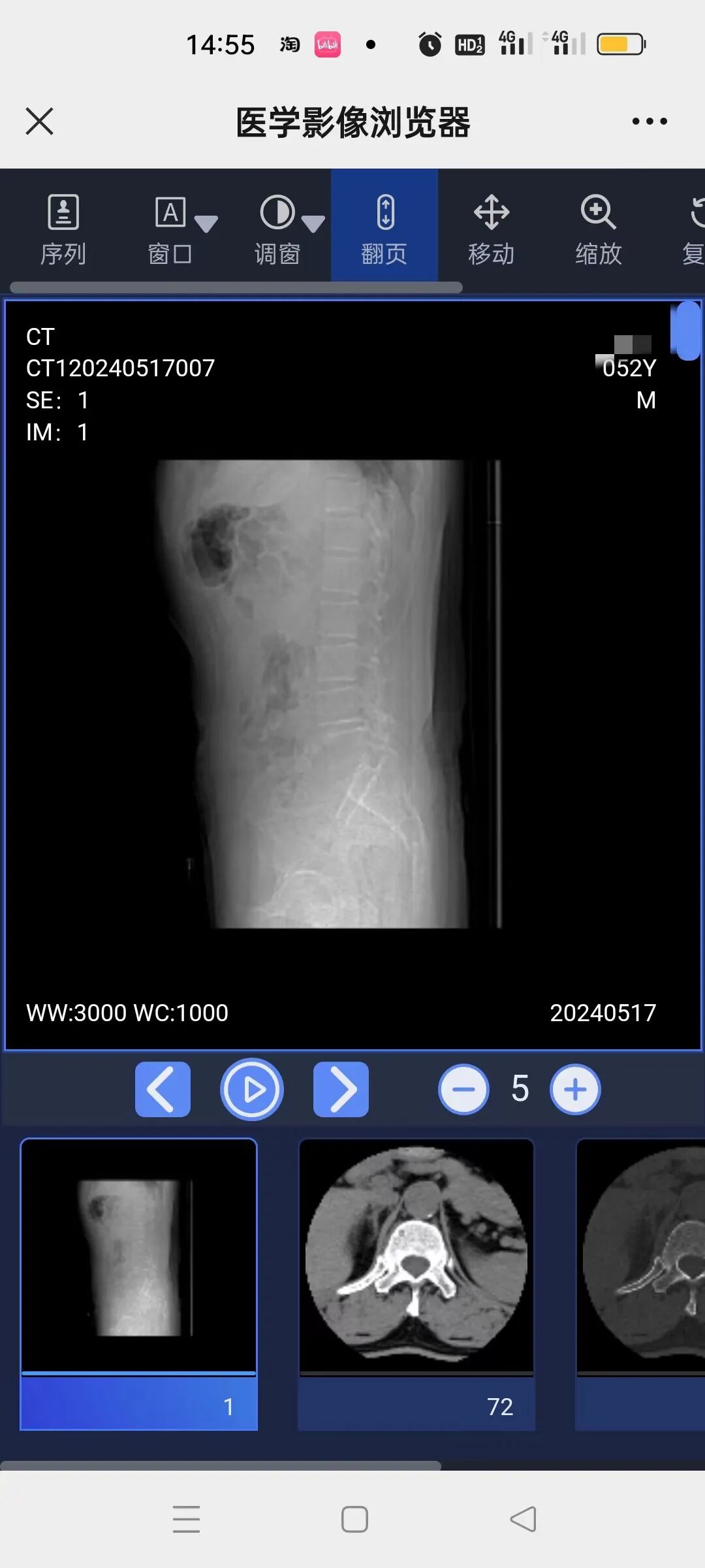 为什么x光片用胶片【便民服务】明村中心卫生院“云胶片”正式上线啦——用手机随时随地就能看X光片、CT片_https://www.jmylbn.com_新闻资讯_第5张