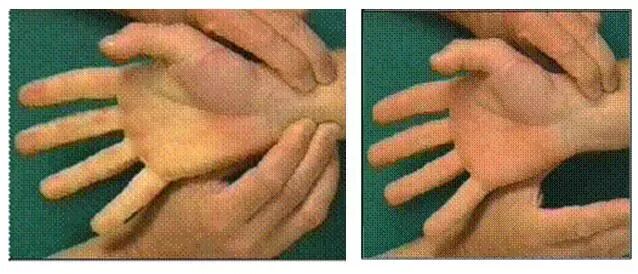 动脉长鞘怎么置入【经验分享】马志敏：条条入路通冠脉——动脉穿刺的这些知识你可能不知道！_https://www.jmylbn.com_新闻资讯_第7张