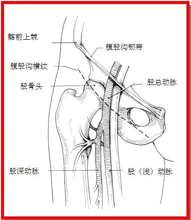 动脉长鞘怎么置入【经验分享】马志敏：条条入路通冠脉——动脉穿刺的这些知识你可能不知道！_https://www.jmylbn.com_新闻资讯_第3张