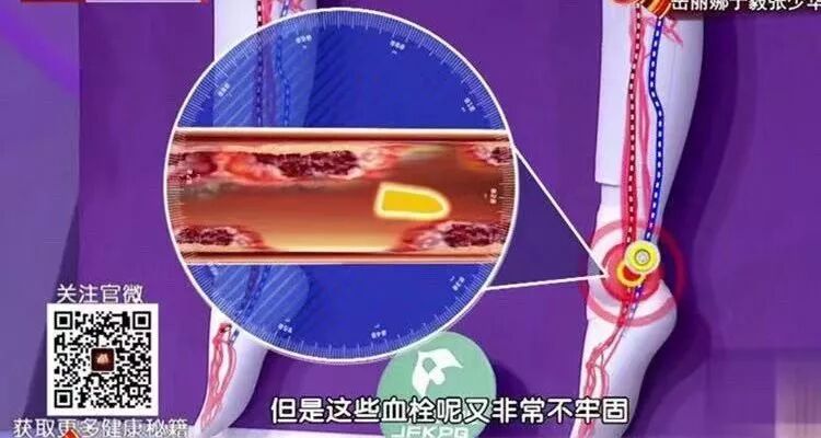 【健康】頭痛、肩痛、肚子痛……忍著？有些痛真的不容忽視，可能是致命信號 健康 第2張