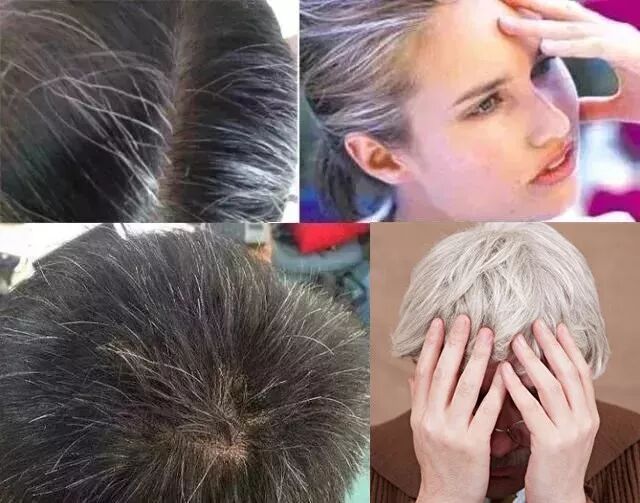 一撮白发，显老5岁，头发变白的真相！