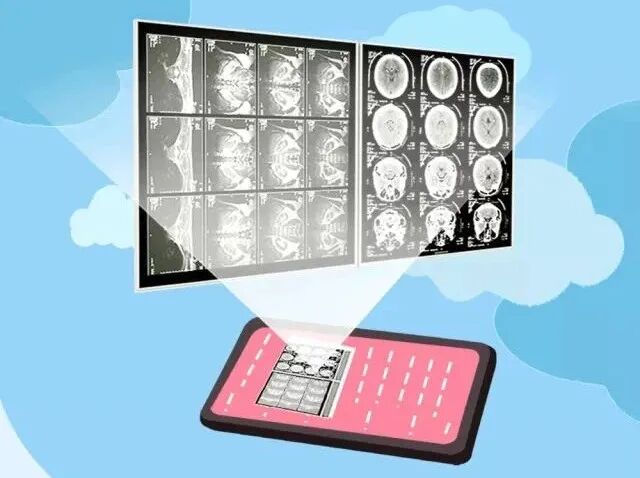 怎么自助取胶片医院【智慧就医】手机扫一扫，取片不用跑——耀州区人民医院“云胶片”上线啦！_https://www.jmylbn.com_新闻资讯_第3张