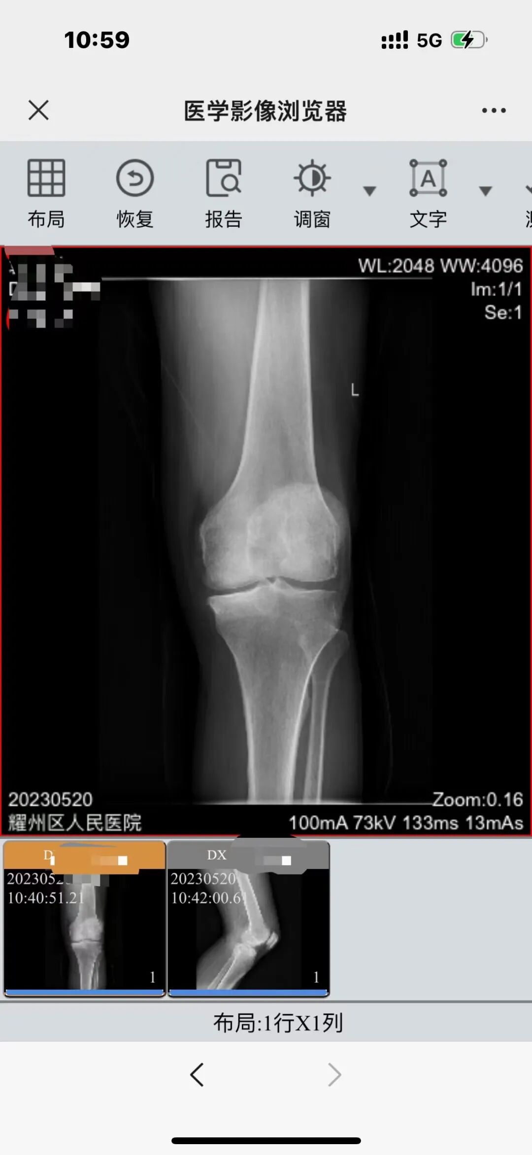 怎么自助取胶片医院【智慧就医】手机扫一扫，取片不用跑——耀州区人民医院“云胶片”上线啦！_https://www.jmylbn.com_新闻资讯_第14张