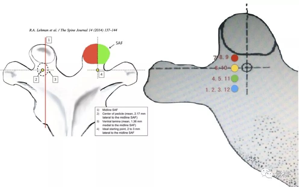 颈椎、胸椎、腰椎椎弓根置钉技巧，真的太实用了！