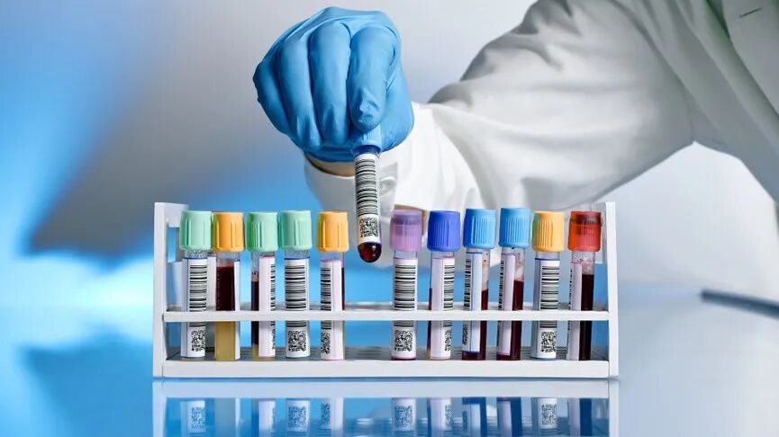 生物样本库的样本制备和存储自动化解决方案