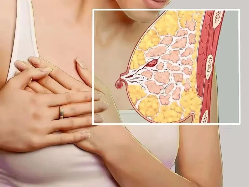 乳腺血氧怎么做做“乳”此美丽的田螺姑娘~_https://www.jmylbn.com_新闻资讯_第7张