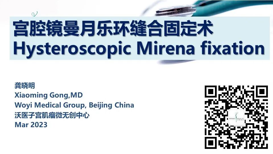 什么是无创缝合每周一手术丨龚晓明教授：宫腔镜曼月乐环缝合固定术_https://www.jmylbn.com_新闻资讯_第6张